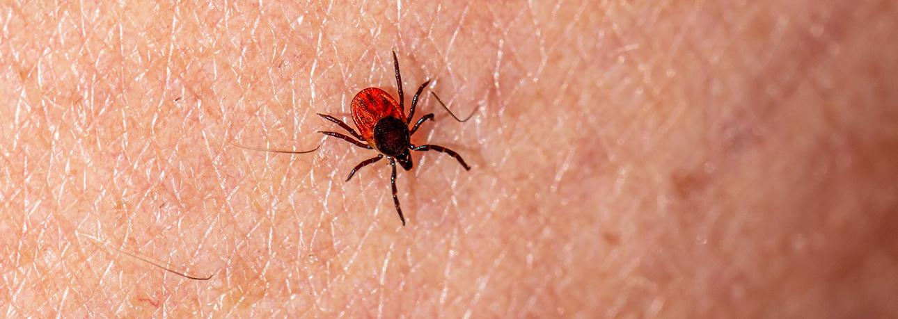 Ticks